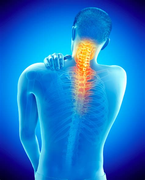 Symptoms and Treatments of Facet Arthropathy