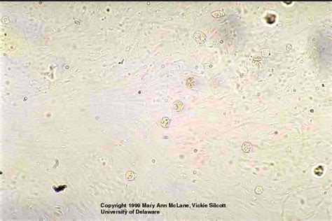 Microscopic Urine Sediment