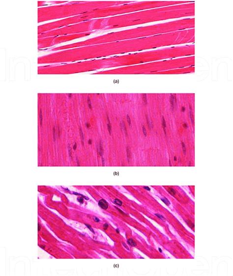 Types Of Muscle Tissue