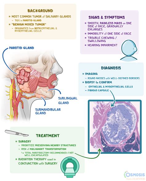 Pleomorphic adenoma: What Is It, Causes, Signs, Symptoms, and More ...