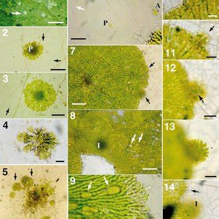 (PDF) In situ development of the foliicolous lichen Phyllophiale ...