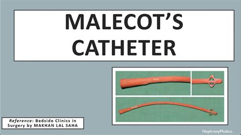 Malecot's Catheter | Surgical Instruments | Rapid Revision | OSPE ...