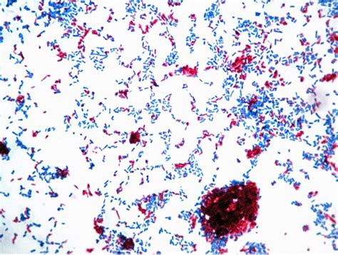 ACID-FAST STAIN – Red Mountain Microbiology