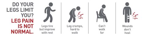 Intermittent Claudication: A Symptom of Peripheral Artery Disease