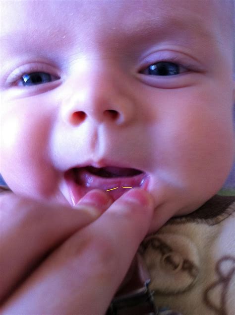 Baby Has Teeth At 4 Months - TeethWalls