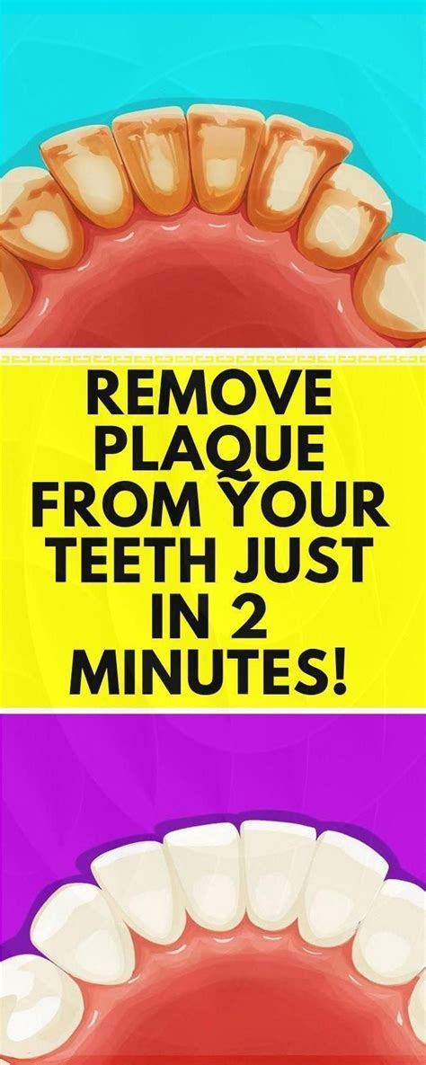 APPLY THIS MIXTURE FOR 60 SECONDS AND REMOVE TARTAR AND PLAQUE FROM ...