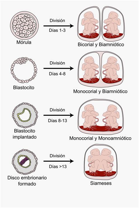 Monochorionic Diamniotic Twins , Free Transparent Clipart - ClipartKey