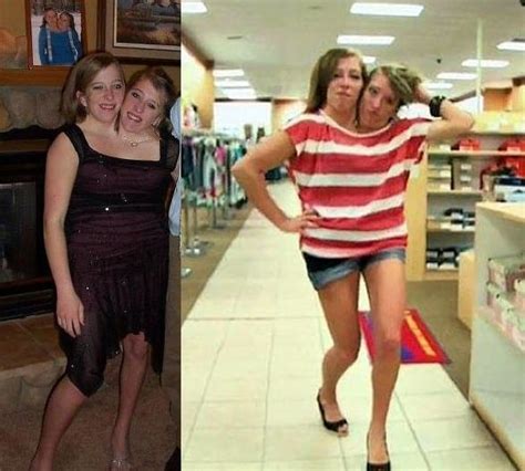 Abby and brittany hensel conjoined twins where are they now - oddlasopa