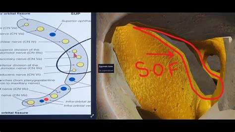 SUPERIOR ORBITAL FISSURE | 3D - ANATOMY | ORBITAL APEX & CONTENTS - YouTube