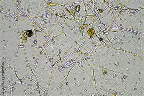 soil fungi under the microscope, soil microbes organisms in a soil and ...