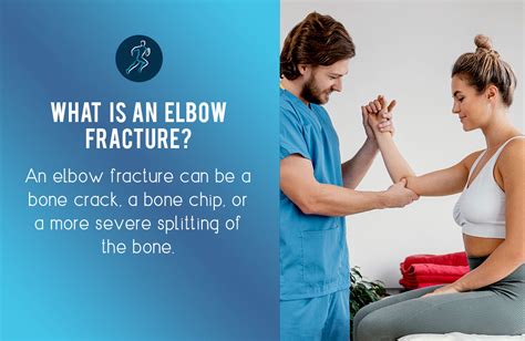 Physiotherapy for Elbow Fracture | Australian Sports Physio