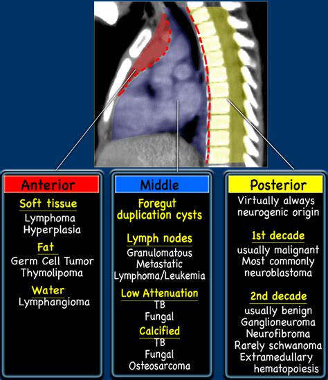 The Radiology Assistant : Pediatric Chest CT 1