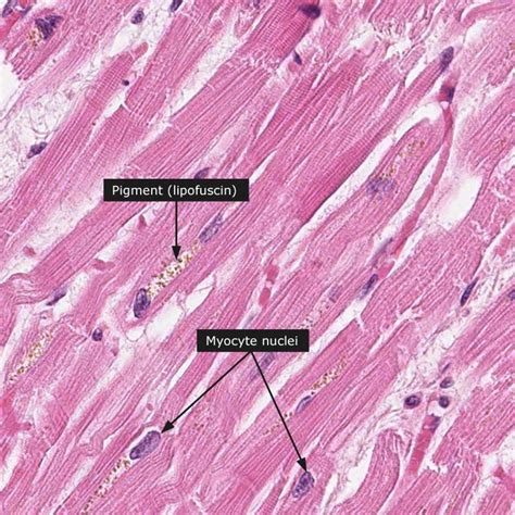 Cardiac Muscle Tissue Histology Slide - Designed by Lashea