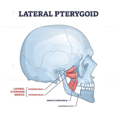 Lateral pterygoid muscle with superior and inferior parts outline ...