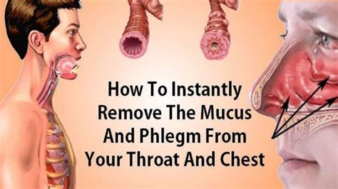 How To Treat Mucus And Phlegm From Your Throat And Chest (Instant Result)