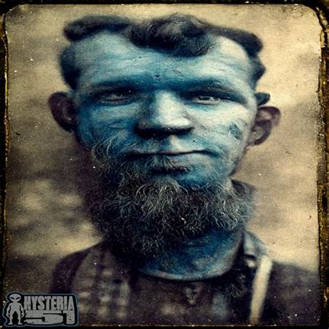 The Fugate Family: The Blue People of Kentucky | 299 | Hysteria 51 ...