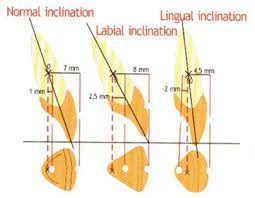 Deciduous Dentition Unit IX - Dental Anatomy Flashcards | Quizlet