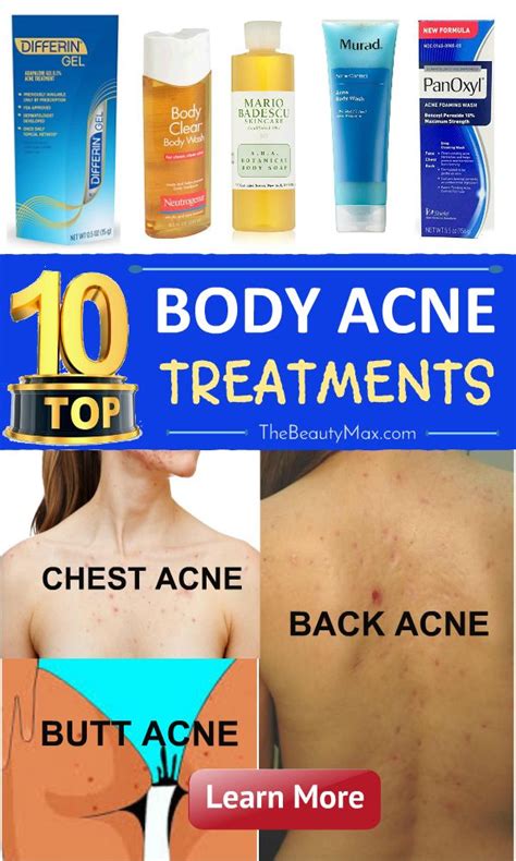 Pin by Acne Go Away on Body acne treatment | Body acne treatment, Body ...