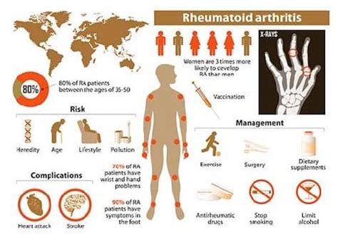 Rheumatoid Arthritis: Symptoms and Treatment