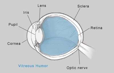 Pathology Outlines - Vitreous humor pathology