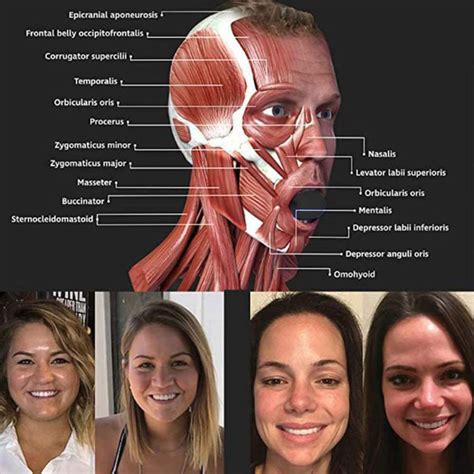 Jawline exerciser käktränare silikon Svart | CDON