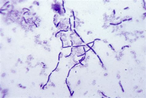 Bacillus - Beneficial Microbes