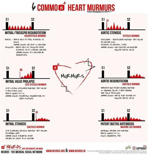 What is a heart murmur? What are some common reasons that heart murmurs ...