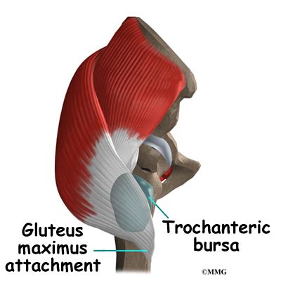 Trochanteric Bursitis of the Hip | eOrthopod.com