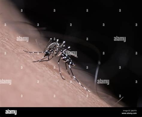 Asian tiger mosquito bites a hairy human skin Stock Photo - Alamy