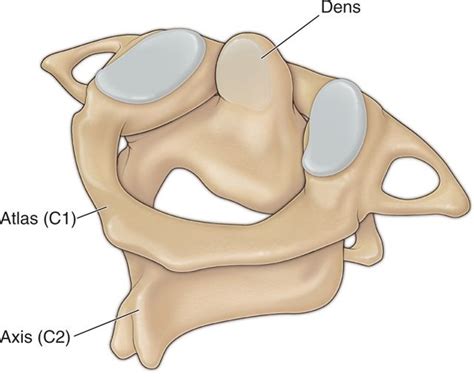 Atlanto-Axial Joint Injections | Anesthesia Key