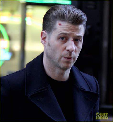 Ben McKenzie Sports Bloody Face During 'Gotham' Filming: Photo 3568146 ...