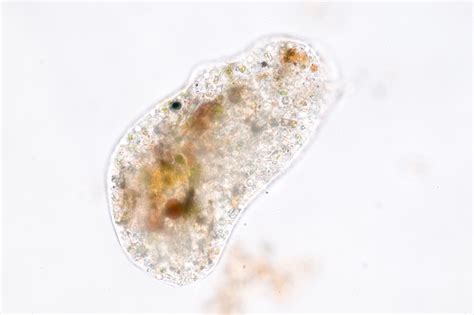 Living Organism Care- Protists