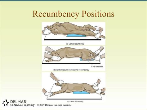 What Is Recumbent Position