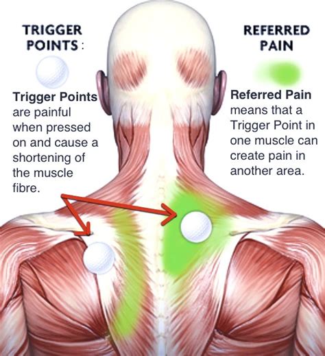 What is a muscle knot, why does it happen and what you can do to relieve it