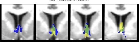 Figure 3 from Comparison of human septal nuclei MRI measurements using ...