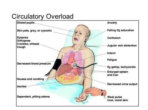 Pin on nclex