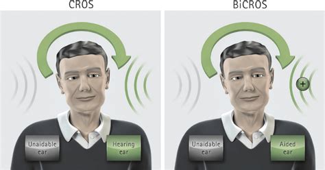 CROS and BiCROS hearing aids - Audiology Island