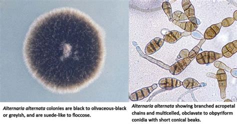 Alternaria alternata- An Overview