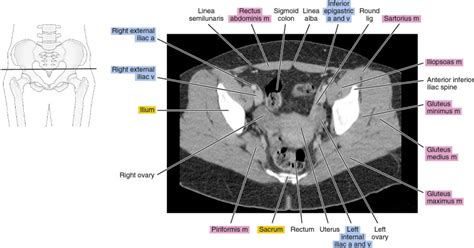 Why Ct Scan Abdomen Pelvis