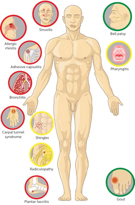 Steroids Drug Effects