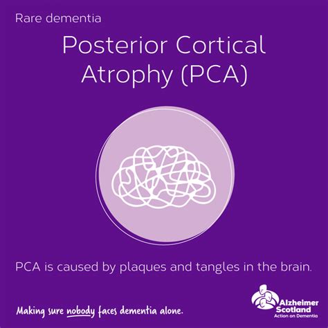 Posterior Cortical Atrophy | Alzheimer Scotland