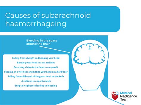 Subarachnoid Haemorrhage Misdiagnosis Claim - Medical Negligence Team