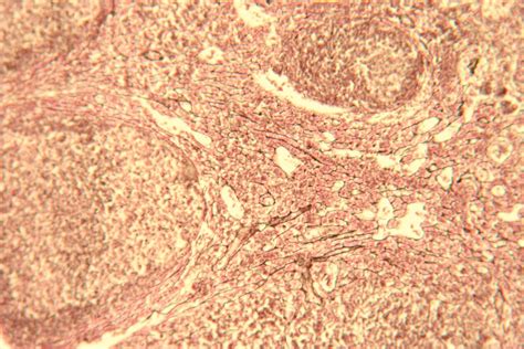 Reticular Lymph Node 100X 2