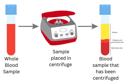 Fresh Frozen Plasma | Storage, Temperature & Uses | FFP