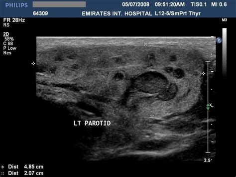 A Gallery of High-Resolution, Ultrasound, Color Doppler & 3D Images