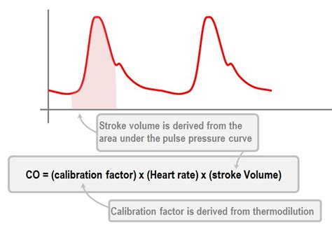 Pulse contour cardiac output measurement | Deranged Physiology