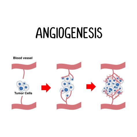 Angiogenesis The formation of new blood vessels 23108007 Vector Art at ...