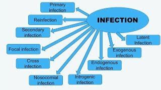 Infection and its various types - Overall Science