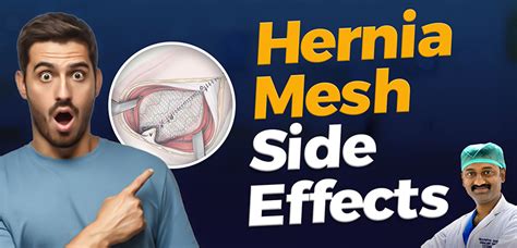 Side Effects of Hernia Mesh | Hernia Mesh Failure Symptoms & Treatment