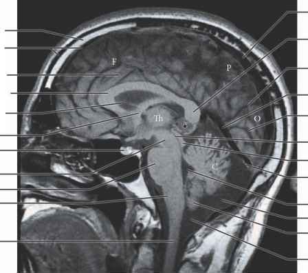 Mri t1 sagittal view radiograph - Spinal Cord - RR School Of Nursing